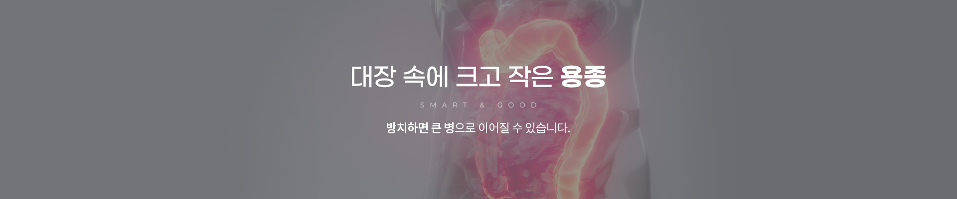 대장내시경/용종절제술 용종